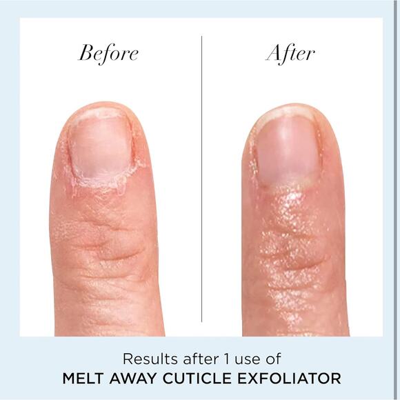 Butter London Cuticle Remover Liquid Exfoliator Melt Away 11 ml $22 - Picture 4 of 6